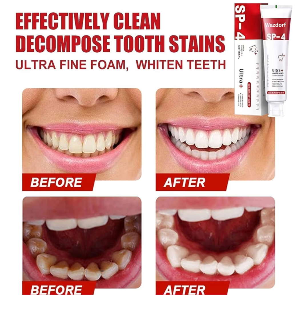 Whitening Toothpaste